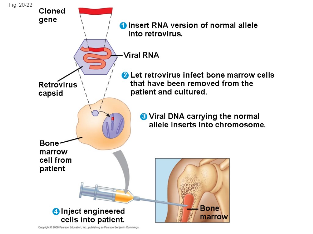 Fig. 20-22 Bone marrow Cloned gene Bone marrow cell from patient Insert RNA version